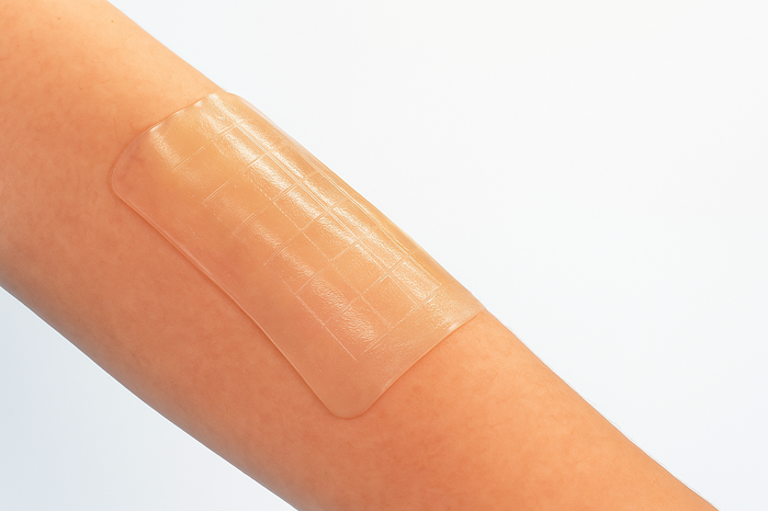 Hydrogel PTLA: Đột phá trong công nghệ vật liệu sinh học