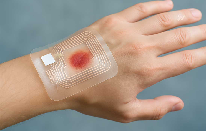 Băng gạc thông minh: Khi trí tuệ nhân tạo tham gia trực tiếp vào quá trình lành vết thương